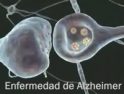 Segovia : Correos deniega una licencia por enfermedad a un trabajador afectado de Alzheimer